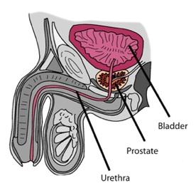 Prostate Cancer Anatomy