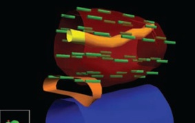 Prostate 3D Computer Model